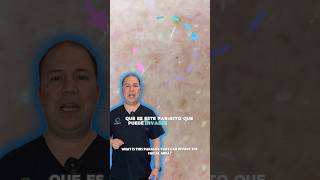 ¿Cómo es tener Demodex dermatologo cuidadodelapiel demodex rosacea onderm monterrey piel [upl. by Yevre39]