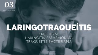 Laringotraqueitis  ENARM [upl. by Curry]