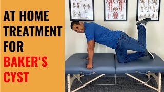 4 Self Treatments For Baker’s Cysts In The Knee [upl. by Enahpad808]