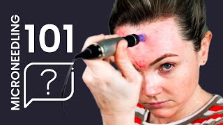 How to MICRONEEDLE 101 Answering Microneedling Pen Questions [upl. by Ainavi162]