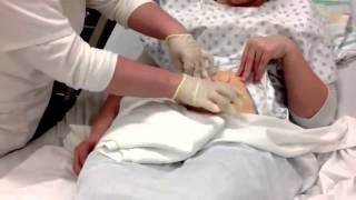 Colostomy Care Teaching Video [upl. by Annid]