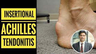 Insertional Achilles Tendinitis How to Diagnose [upl. by Sidoon638]