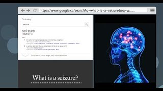 What Are Seizures and How to Recognize Them [upl. by Damali]