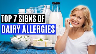 Top 7 Signs of a Dairy Allergy Signs of CMPA [upl. by Relyuc]