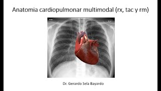 ANATOMIA PULMONAR Y CARDIOVASCULAR 23 1 [upl. by Berri330]