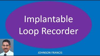 Implantable Loop Recorder [upl. by Ayote]