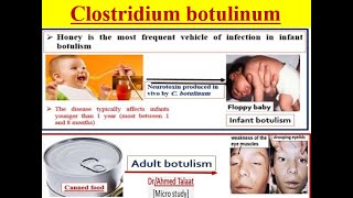 Clostridium botulinum Botulism disease quotMedical microbiology [upl. by Akimahc296]