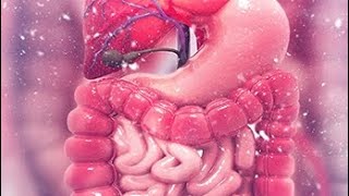 Carcinoma of the colon and rectum [upl. by Burget]