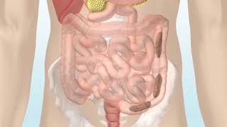 Qué es la metaplasia intestinal [upl. by Ferree]