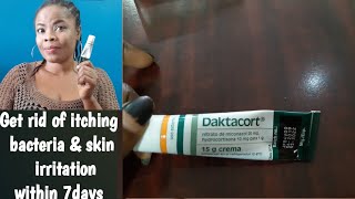 Daktacort antifungal cream review [upl. by Aramas]