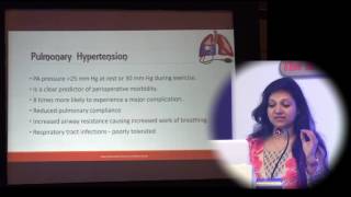 DAY 2  PRESENTATION 11 BY DR AMARJA NAGRE [upl. by Sydalg281]