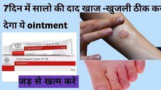 clotrimazole cream  clitrimazole cream ke uses  फंगल इन्फेक्शन की बेस्ट दवा  uses  side effects [upl. by Horowitz]