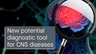 Novel detection system for prognosis of CNS diseases unveiling the EV Neuro assay [upl. by Hannavas]