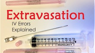 Extravasation  IV Infiltration Errors Explained Doctor Interview [upl. by Blodget]