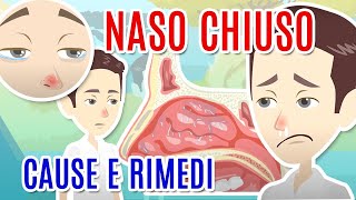 NASO CHIUSO cause diagnosi e cure per la CONGESTIONE NASALE [upl. by Eddana796]