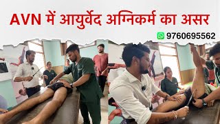 AVN कूल्हे में सड़न का ईलाज  AYURVEDA AGNIKARMA 🔥 [upl. by Aisetal]