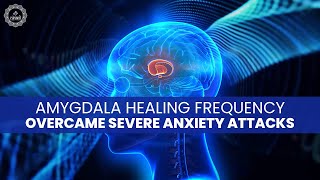 Amygdala Healing Frequency  Rewiring The Anxious Brain  Overcame Severe Anxiety Attacks  Heal [upl. by Anitsud]