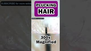 Plucking Hair at 300x Magnified  See the root keratin skin cells and follicle [upl. by Edison]