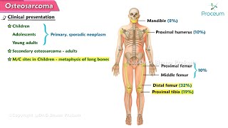 Osteosarcoma 🦴  Orthopedic lectures [upl. by Feinstein]