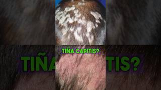 Tratamiento para Tiña Capitis tiñacapitis tratamiento salud griseofulvina viralvideo [upl. by Dannica]