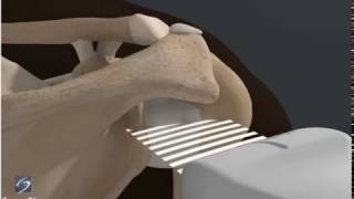 How To Shoulder Glenohumeral Joint 3D Video [upl. by Polly598]