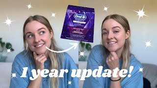 Oral B 3d Whitestrips  1 Year update amp enamel contouring [upl. by Loleta775]