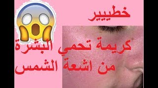 ☀☀☀وجهي ايتحرقلي بالشمس😲😲😲 [upl. by Hanikehs]