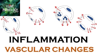 INFLAMMATION Part 1 General concepts types  Vascular changes in Acute inflammation [upl. by Madelin]