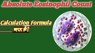 Absolute Eosinophil count testProcedure  normal rangehigh means [upl. by Ahsotan]