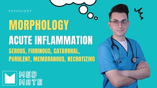 Morphology of acute inflammation [upl. by Magna]