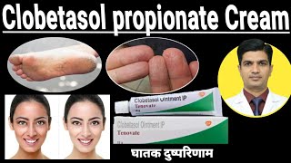 Clobetasol Cream ip tenovate  Clobetasol propionate cream [upl. by Wardlaw850]