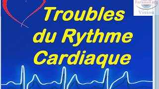 Troubles du rythme cardiaque chez lHypertendu [upl. by Ready900]