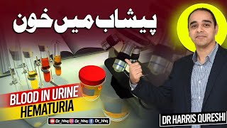 Blood In Urine  Hematuria پیشاب میں خون  DrHarris Qureshi [upl. by Enilarak]