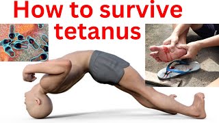 How to survive tetanus  tetanus treatment and cure tetanus sympyoms and prevention [upl. by Luci]