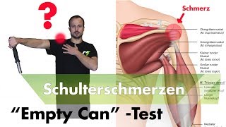 Schulterimpingement Testen  Supraspinatussehne Entzündet [upl. by Kealey153]