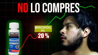 MAS  DE MINOXIDIL MAS BARBA NO LO COMPRES SIN VER ESTE VIDEO [upl. by Wadleigh606]