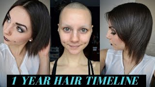 1 Year Hair Growth Timeline Bald amp No Eyebrows [upl. by Nebe395]