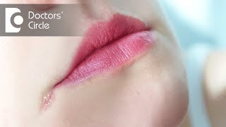 How to manage Angular Cheilitis  Dr Aniruddha KB [upl. by Koerlin]