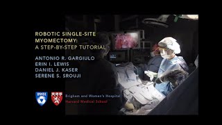 Robotic Singlesite Myomectomy Video  Brigham and Women’s Hospital [upl. by Asit]