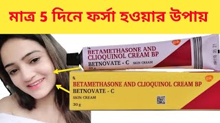 BETNOVATE C SKIN CREAM ফর্সা হবার উপায়  BETNOVATE C CREAM BANGLA REVIEW [upl. by Flowers]