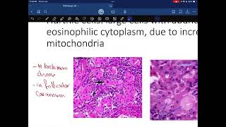 Pathology lab endocrine system [upl. by Nnyleuqcaj104]