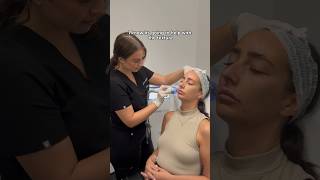 From Skin Assessment to Radio Frequency Microneedling at Dr Medispa Knightsbridge [upl. by Ader267]