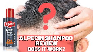 Alpecin Shampoo Review  Do We Recommend It [upl. by Mcclure]