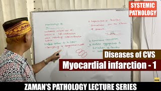 Systemic Pathology Lecture 35  Diseases of CVS  Day 05  Myocardial infarction  01 [upl. by Flan535]