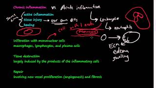 28  Chronic Inflammation  Introduction Macrophages [upl. by Heather]