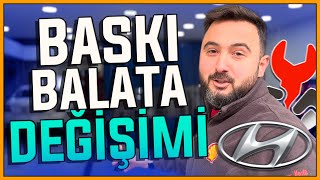 ❓🔥Baskı Balata Değişiminde Dikkat Edilmesi Gerekenler [upl. by Bron]