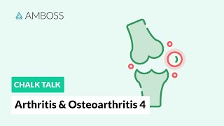 Arthritis amp Osteoarthritis  Part 4 Joint Involvement Patterns in Rheumatic Diseases [upl. by Rabkin104]