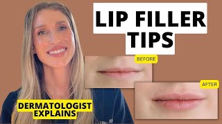 Dermatologist Shares 9 Lip Filler Tips to Know Before and After Treatment [upl. by Xel193]