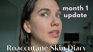 Roaccutane Daily Skin Diary  Taking Accutane For A SECOND Time Low Dose  Month 1 [upl. by Jenn269]