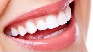 Svelato il Segreto per Denti Bianchissimi [upl. by Morganne]